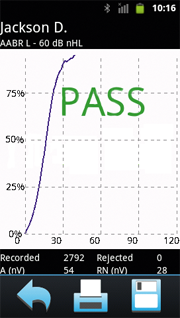 Neuro-Audio-Screen_ABR_180.png